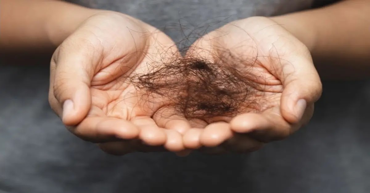 كيفية منع تقصف الشعر: 10 نصائح ذهبية لصحة شعرك