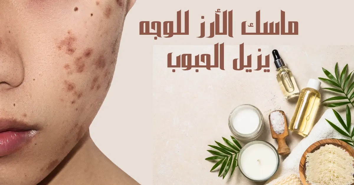 ماسك الأرز للوجه يزيل الحبوب.. وصفات طبيعية للعناية بالبشرة المعرضة للشوائب