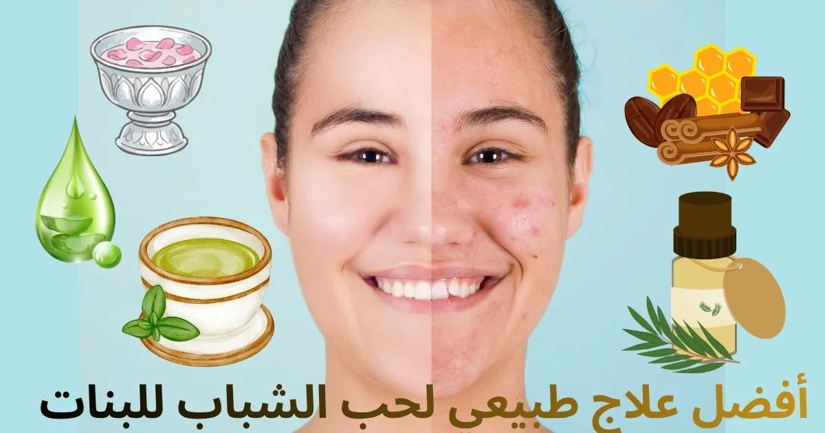 أفضل علاج طبيعي لحب الشباب للبنات