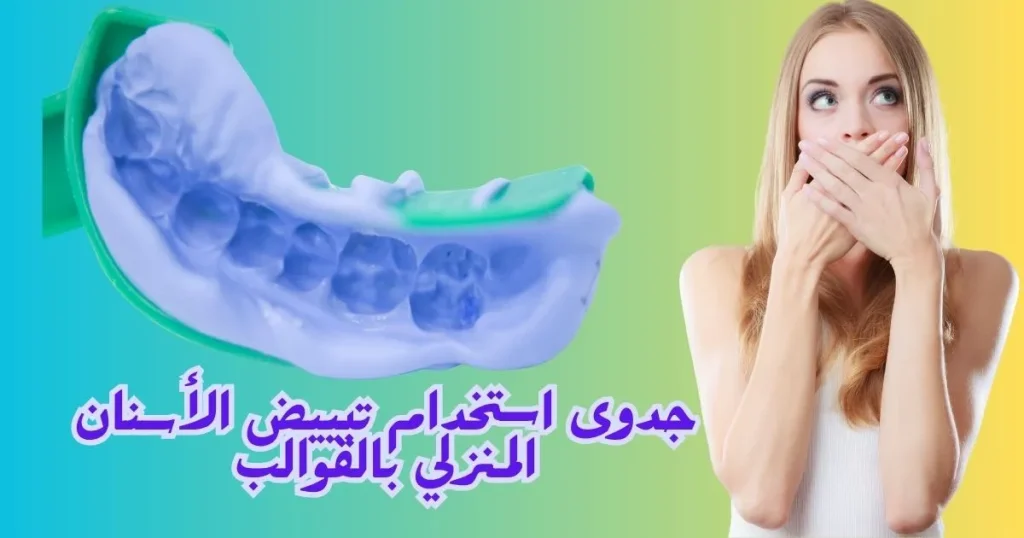 تبييض الأسنان المنزلي بالقوالب