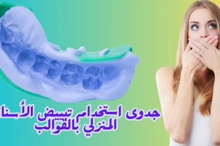 تبييض الأسنان المنزلي بالقوالب