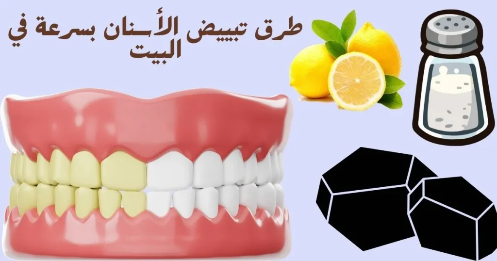  طرق تبييض الأسنان بسرعة في البيت