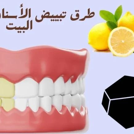 طرق تبييض الأسنان بسرعة في البيت