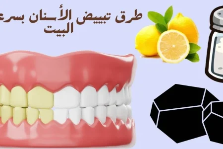 طرق تبييض الأسنان بسرعة في البيت