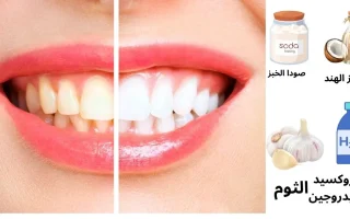 أفضل طرق تبييض الأسنان في المنزل