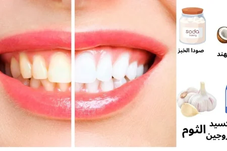 أفضل طرق تبييض الأسنان في المنزل