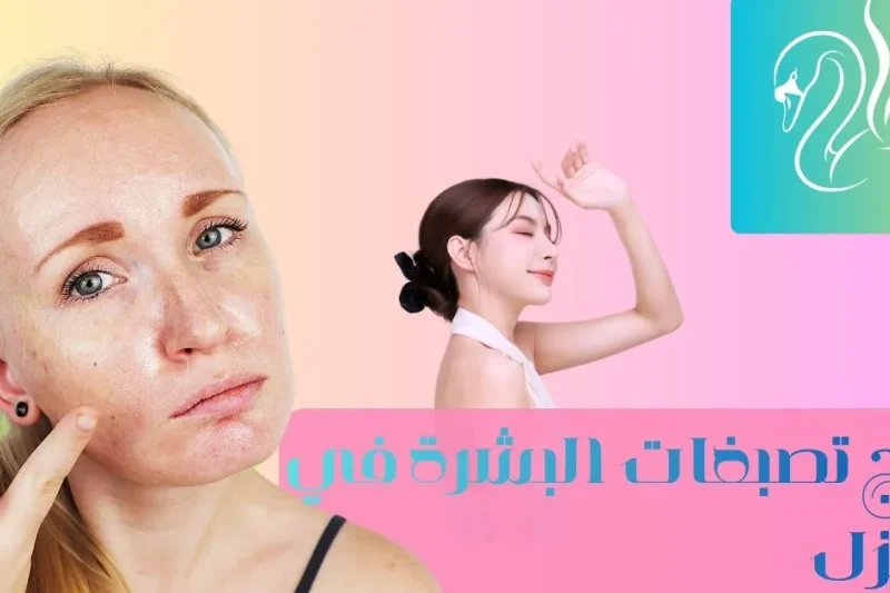 علاج التصبغات طبيعيا