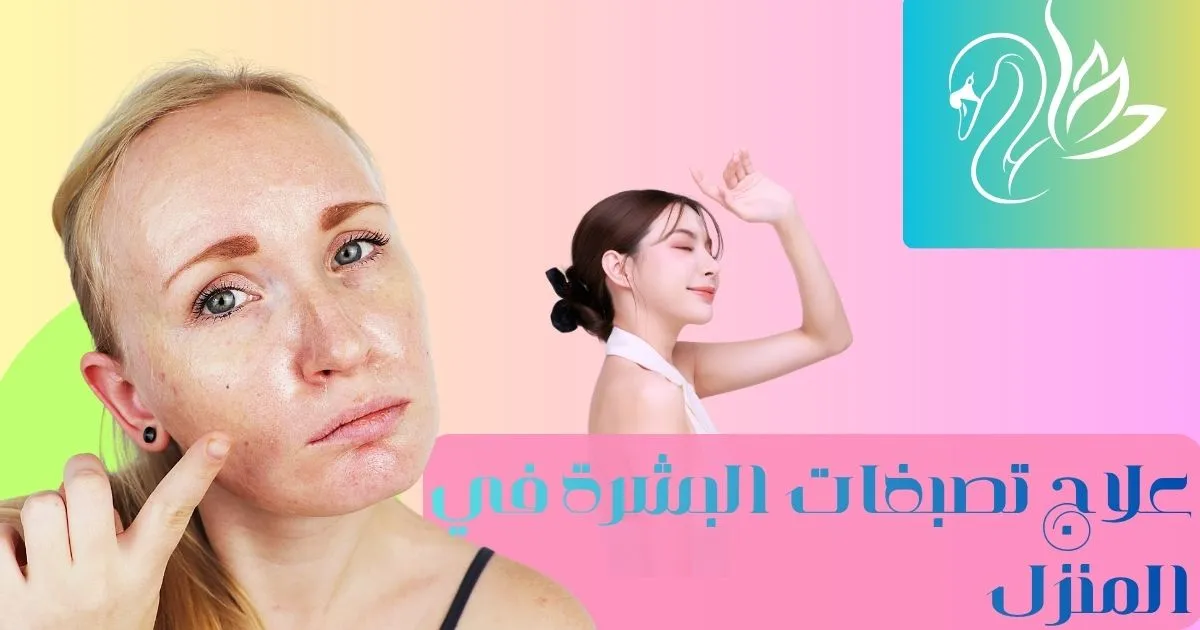 علاج التصبغات طبيعيا: 5 وصفات منزلية سهلة لتوحيد لون البشرة