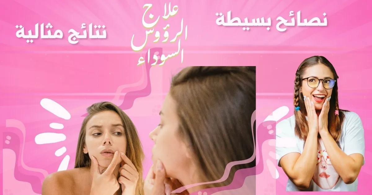 علاج الرؤوس السوداء للبشرة الدهنية: وصفات وخطوات مجربة