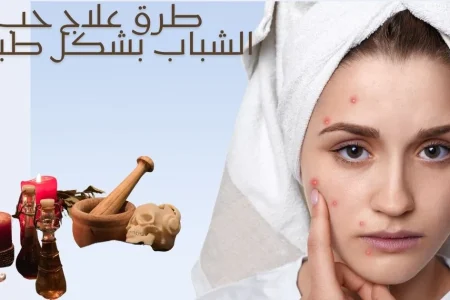 علاج حب الشباب طبيعيًا بسرعة بالمنزل