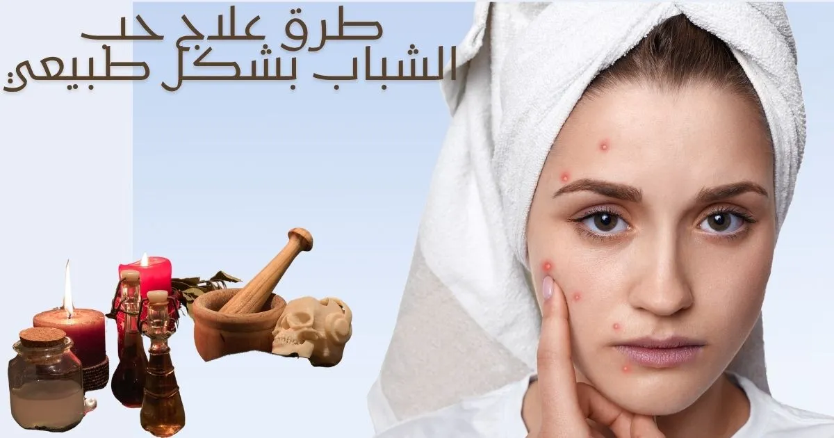علاج حب الشباب طبيعيًا بسرعة بالمنزل