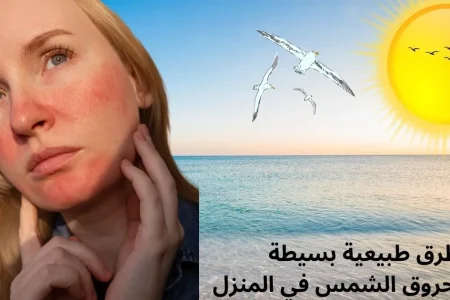 علاج حروق الشمس من البحر في المنزل