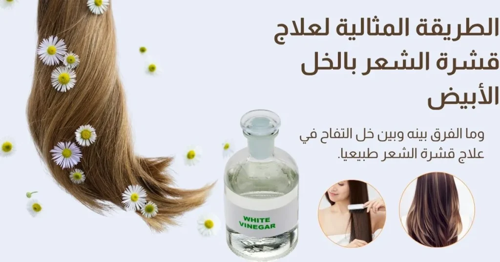 علاج قشرة الشعر بالخل الأبيض