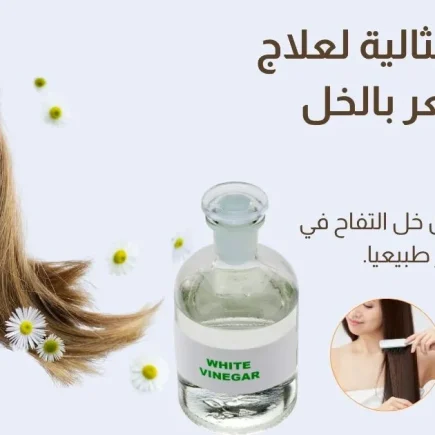 علاج قشرة الشعر بالخل الأبيض