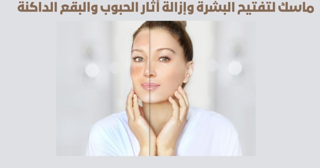 ماسك لتفتيح البشرة وإزالة آثار الحبوب والبقع الداكنة