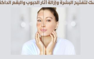 ماسك لتفتيح البشرة وإزالة آثار الحبوب والبقع الداكنة