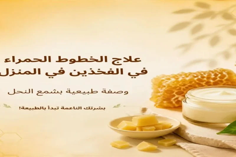 علاج الخطوط الحمراء في الفخذين في المنزل - وصفة طبيعية بشمع النحل، مع مكونات طبيعية لترطيب البشرة وتقليل ظهور الخطوط، وصفة مجربة وآمنة للبشرة.